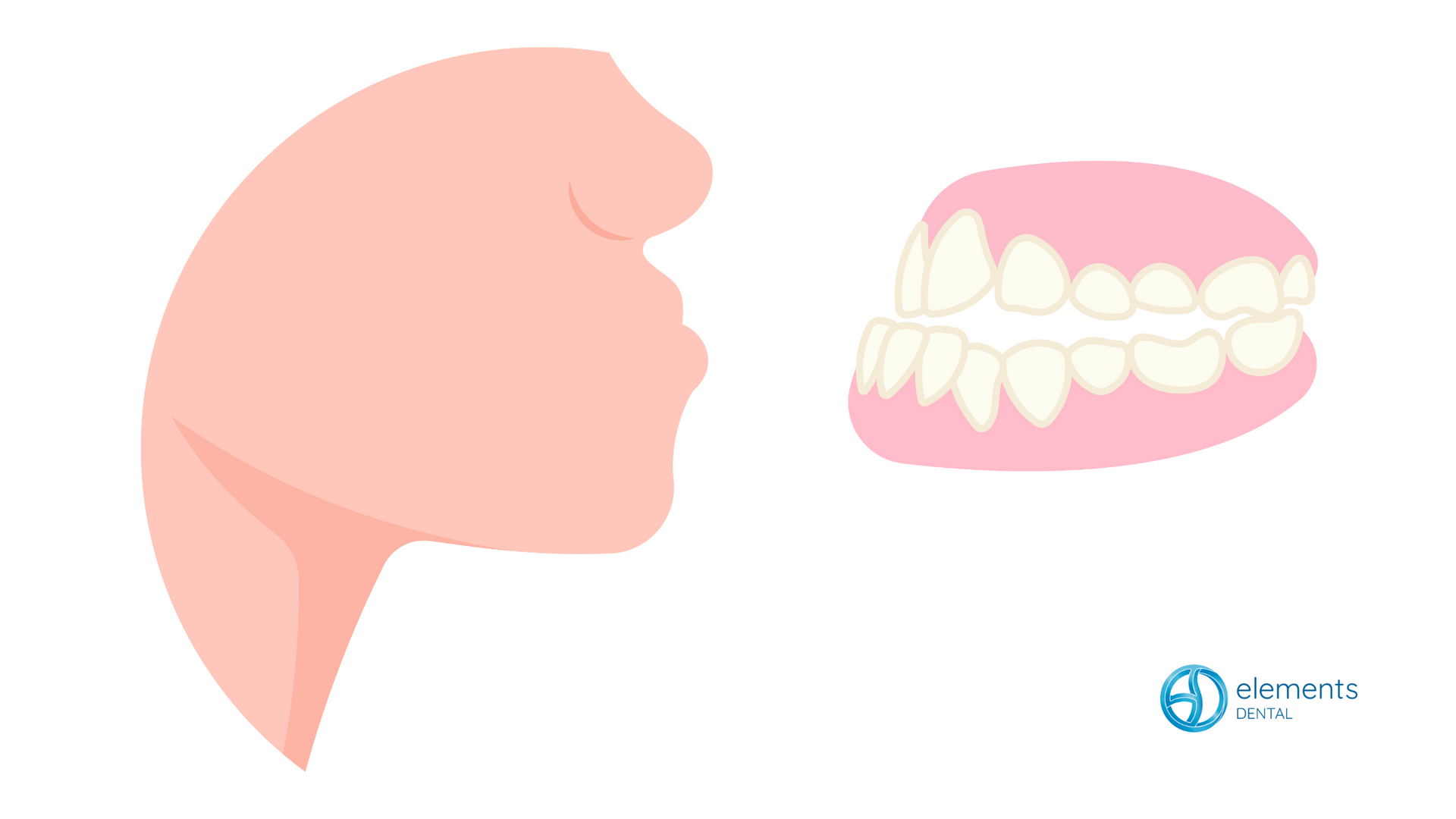 A cartoon illustration of a woman 's mouth and teeth.