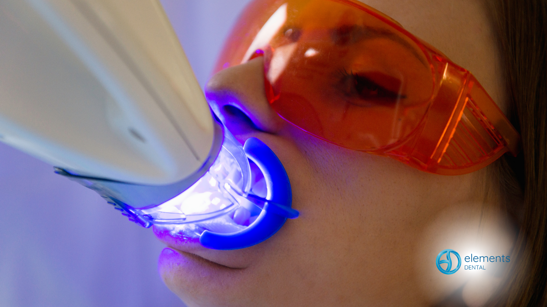 A woman wearing safety glasses is getting a teeth whitening treatment.