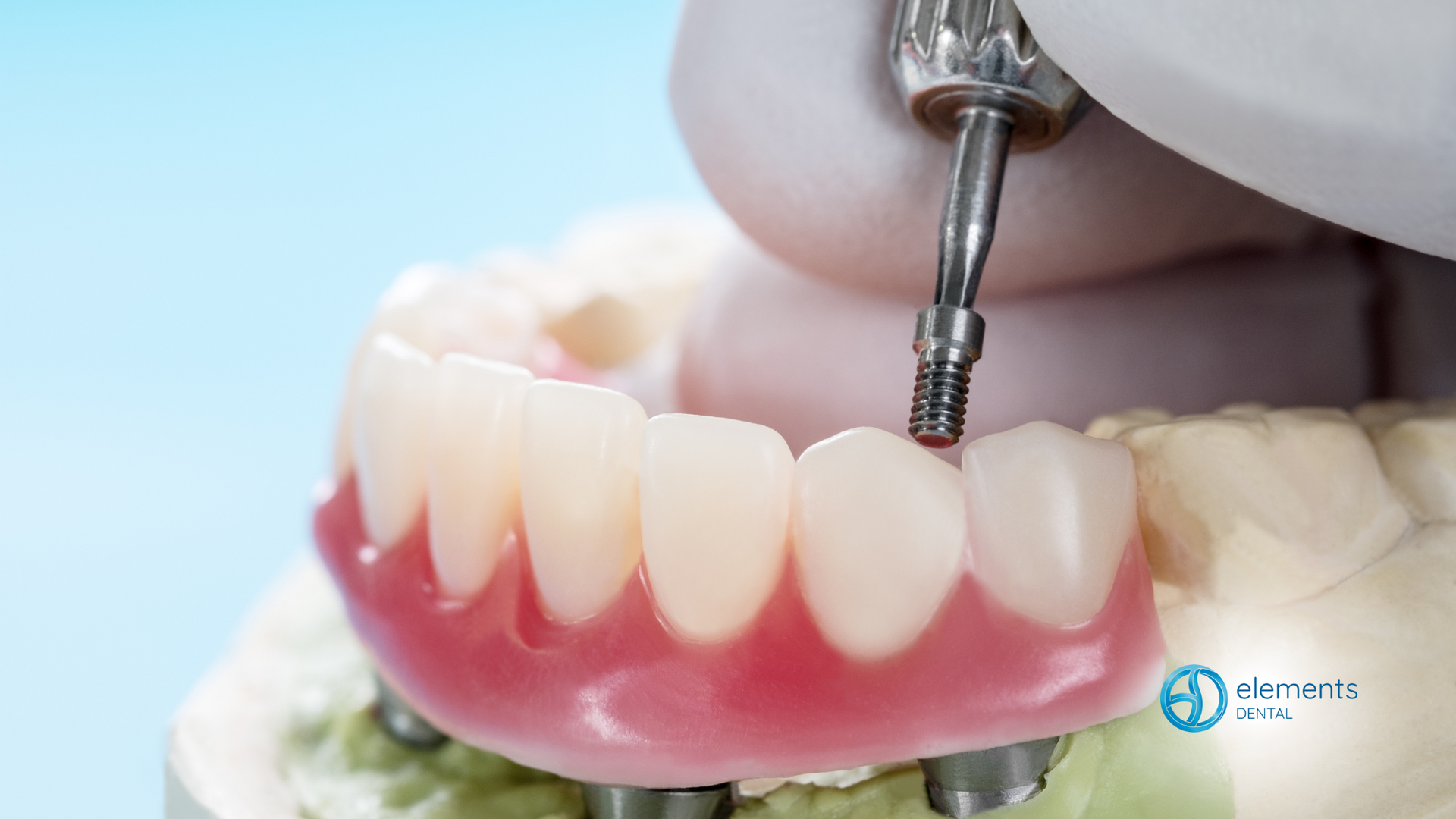 A close up of a denture being installed on a model.