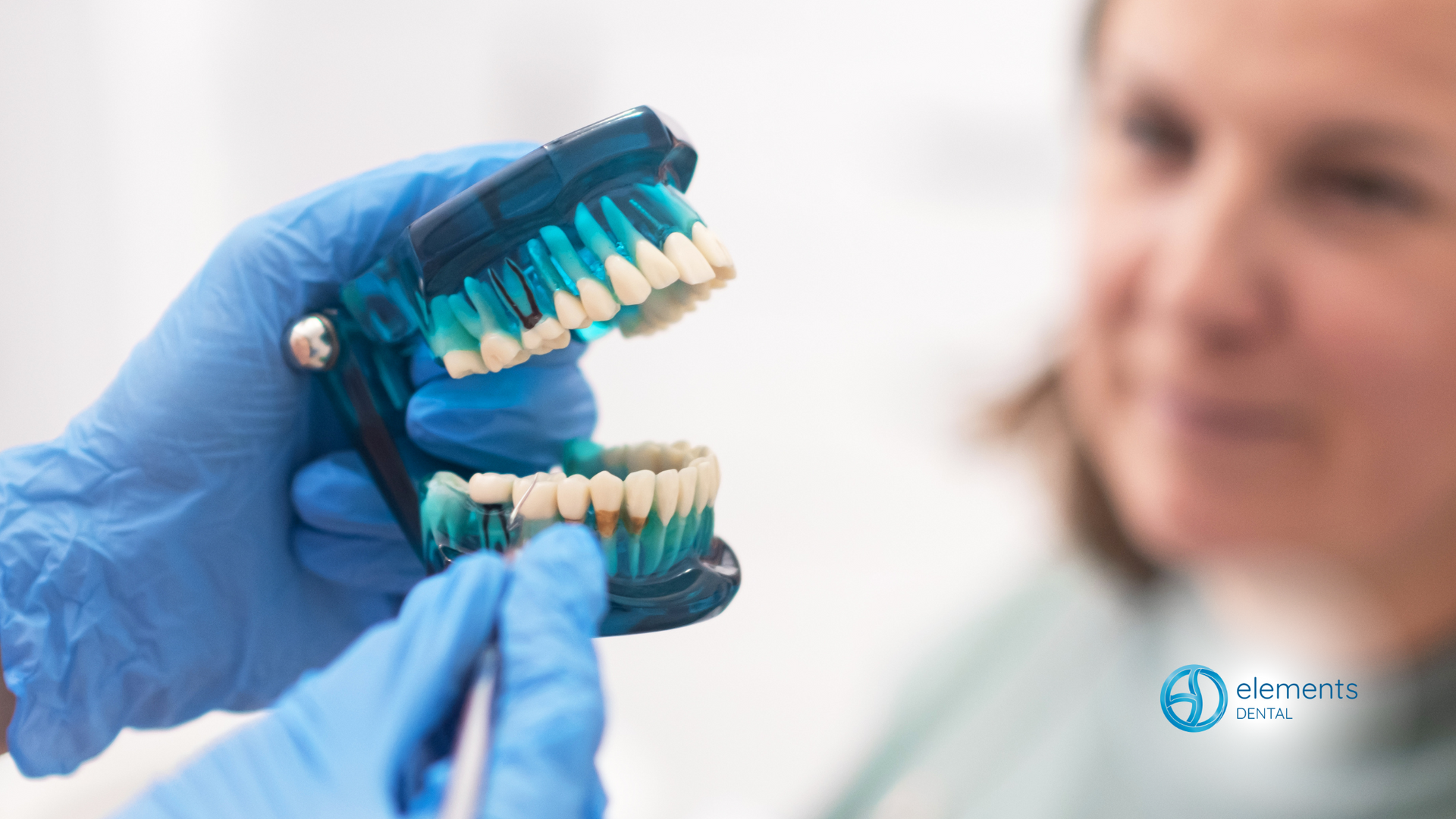 A dentist is holding a model of a person 's teeth in front of a woman.