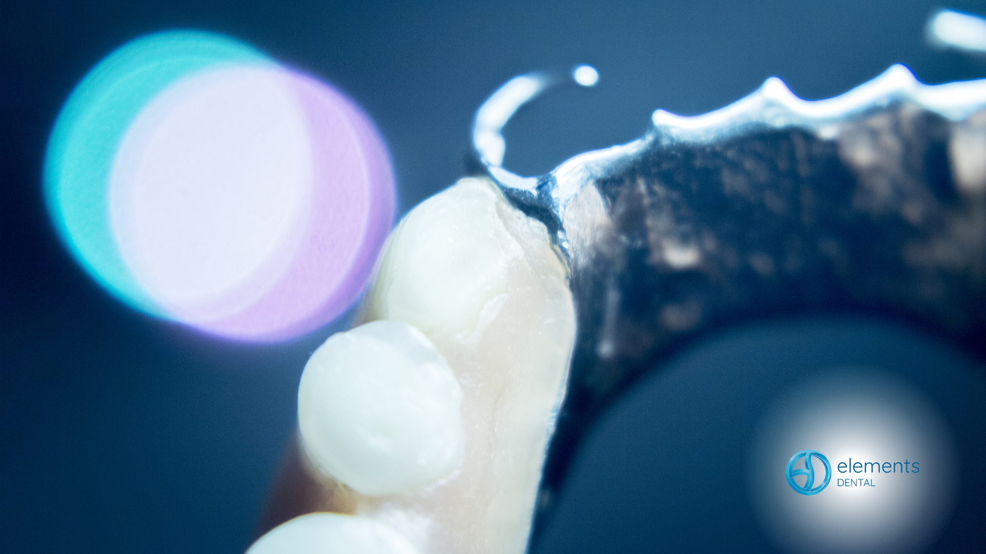 A close up of a person holding a denture in their hand.