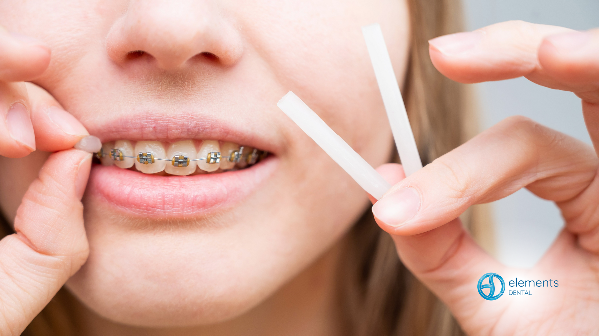 A woman with braces is holding a piece of tape in her mouth.