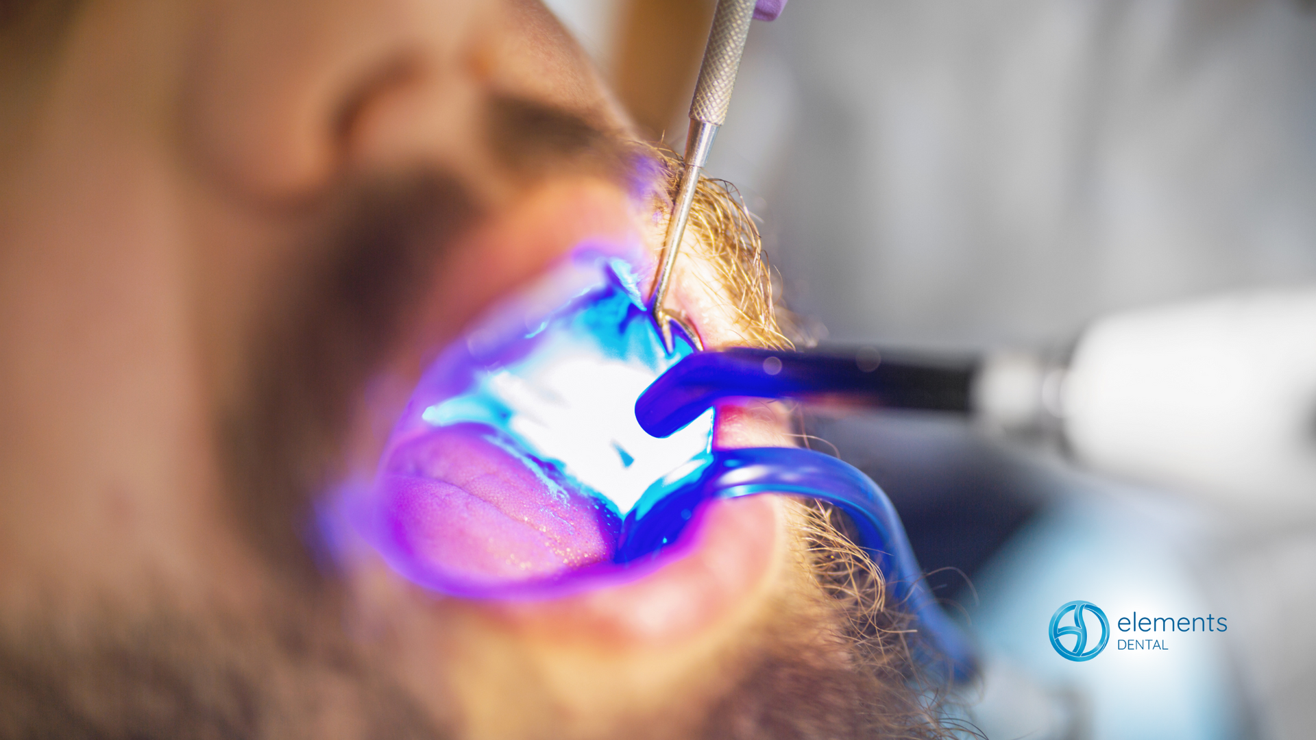 A man is getting his teeth whitened by a dentist.