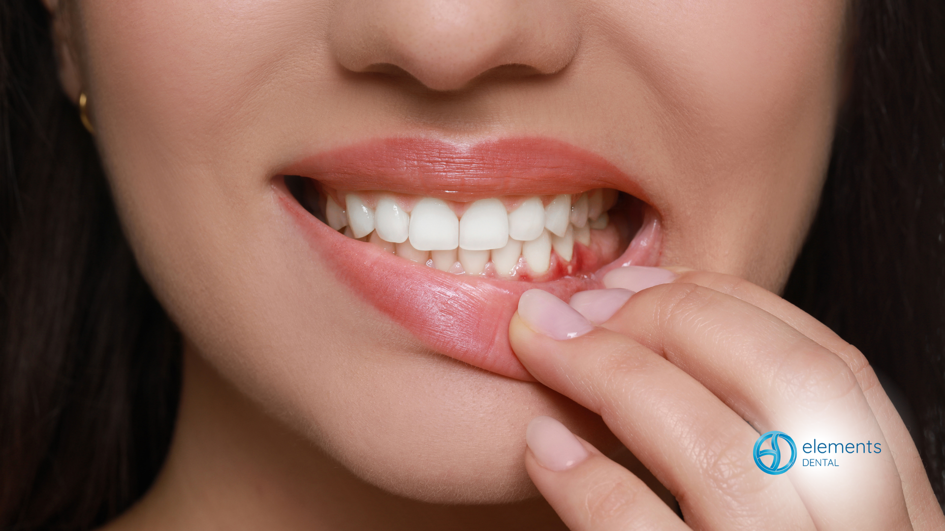 Close-up of a person flossing front teeth with a pink floss pick, showing a smile.