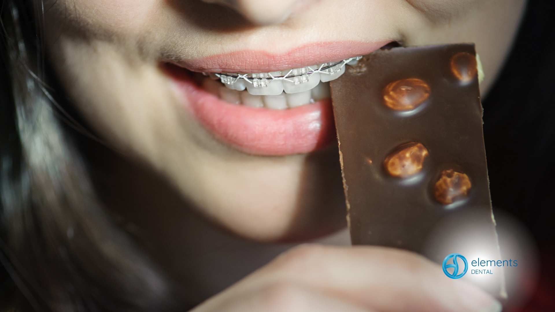 A woman with braces is eating a piece of chocolate.