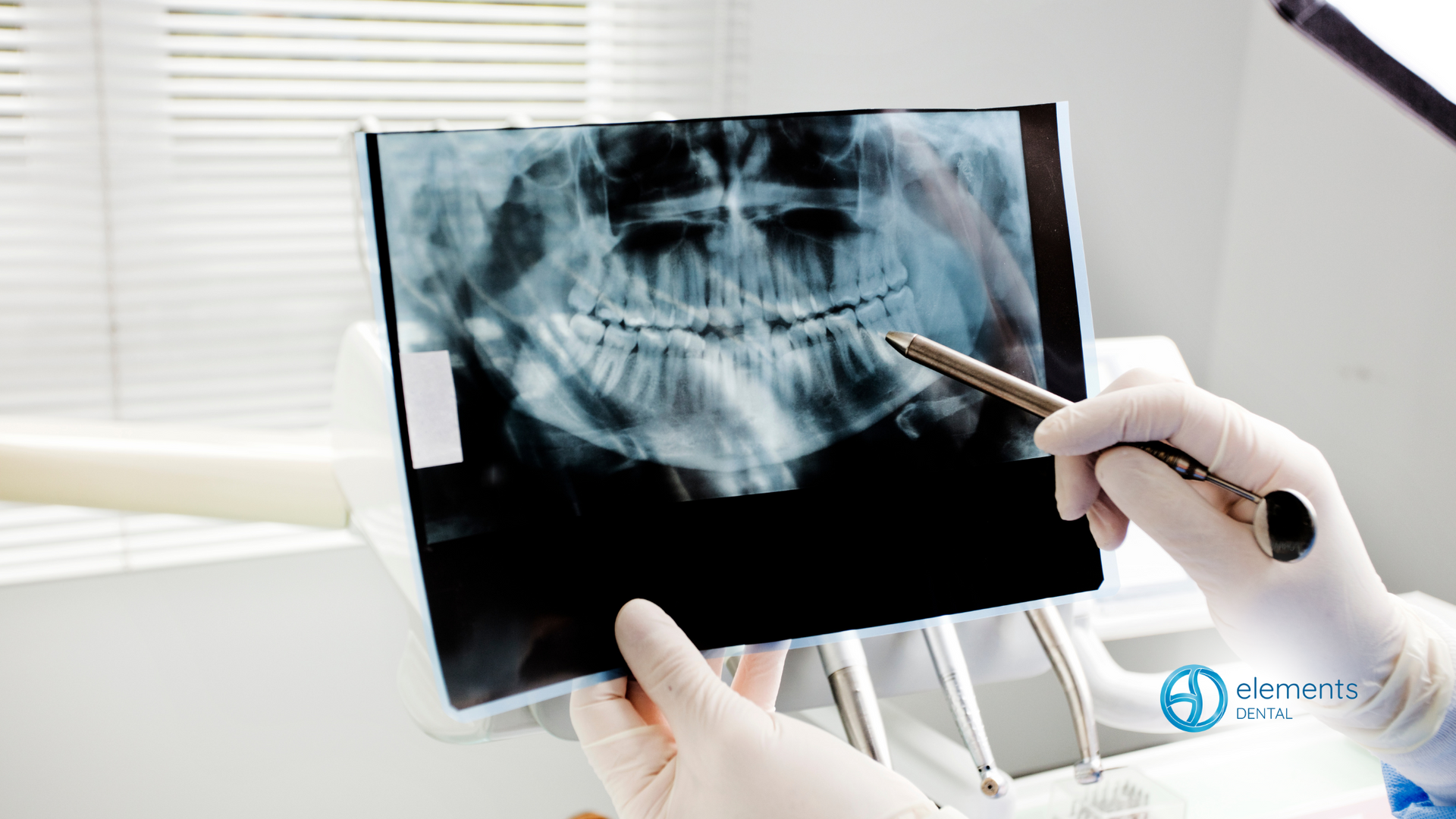 A dentist is holding an x-ray of a person 's teeth.