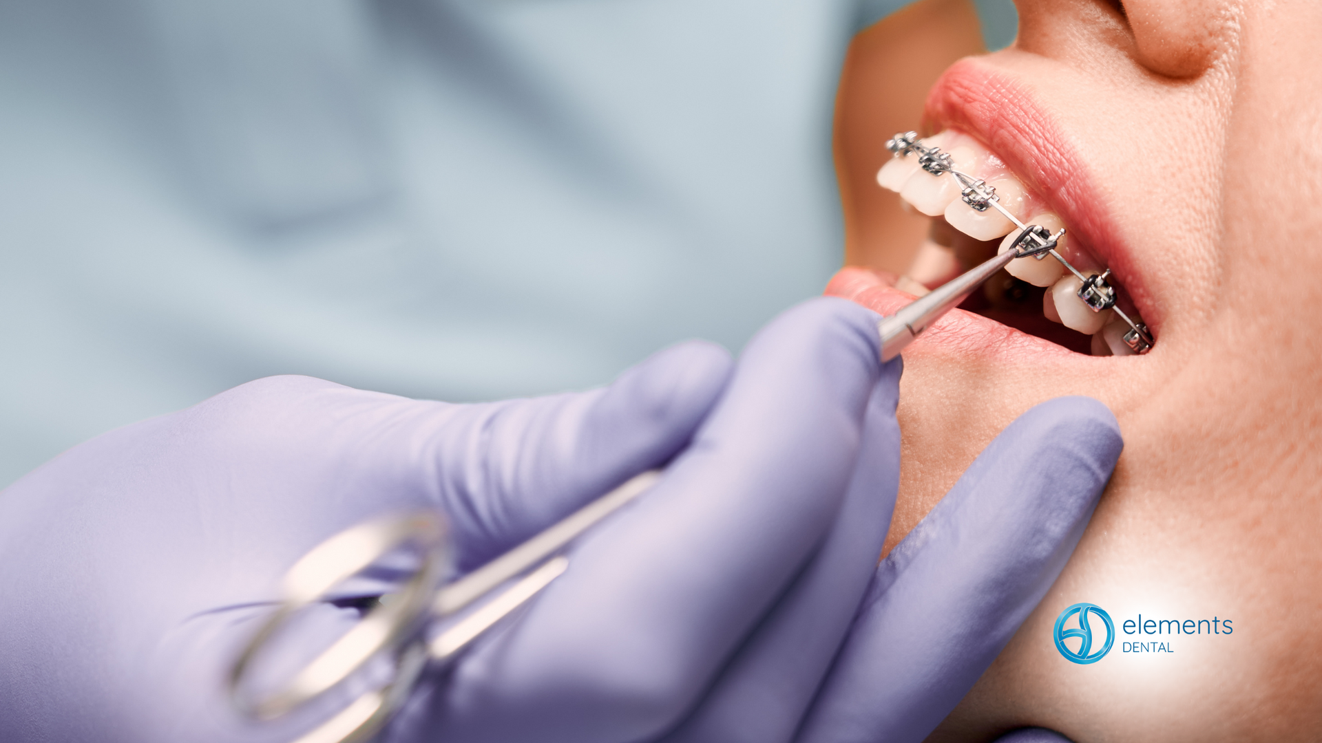 A woman with braces is getting her teeth examined by a dentist.