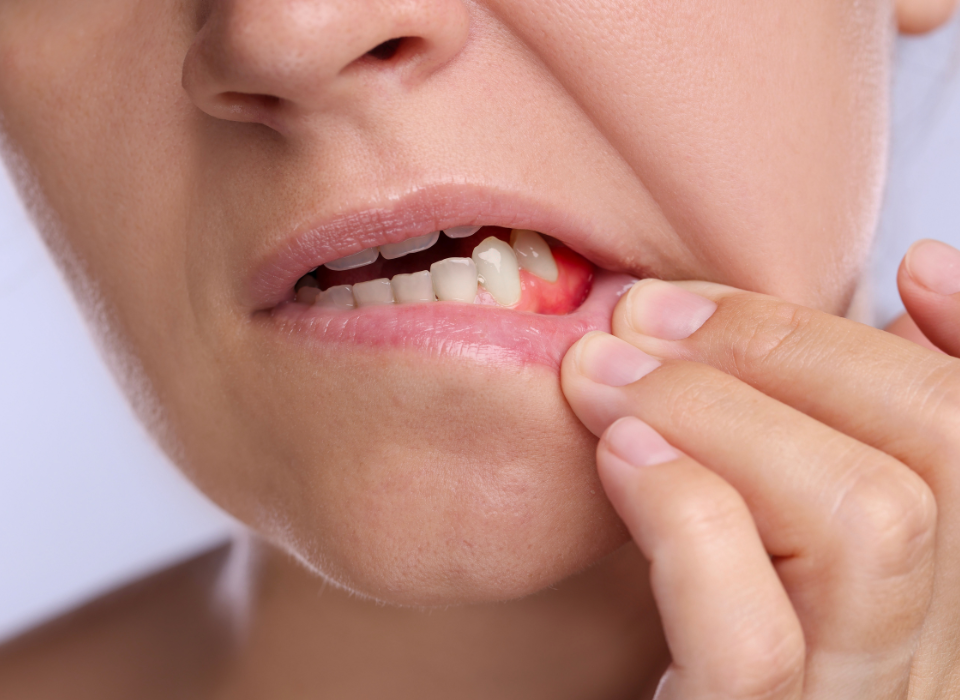 Hand pulling a loose front tooth from a person's mouth, with visible bleeding around the gum.