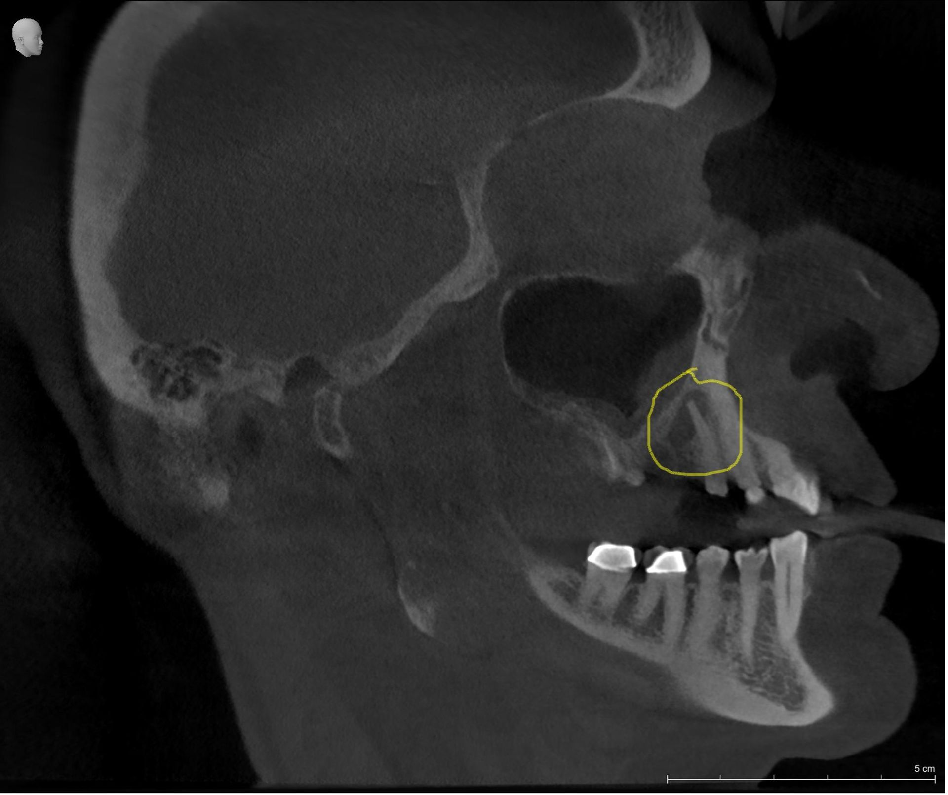 A black and white image of a skull with a yellow circle around it