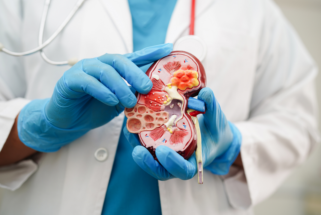 A doctor is holding a model of a kidney in his hands.