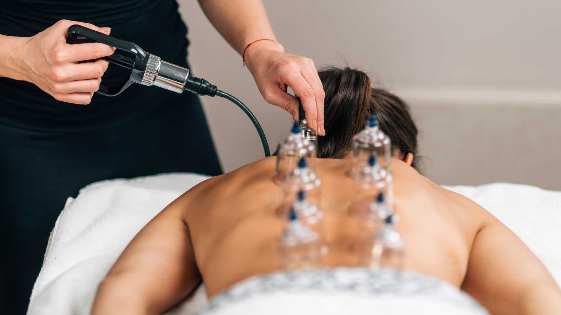 a woman is getting a cupping treatment on her back .