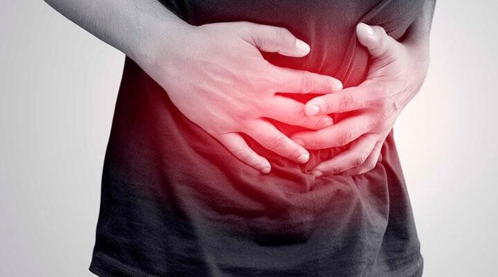 DR. FREDY BELMONTE PÉREZ - COLITIS