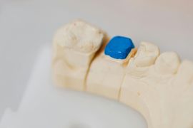 banana-river-dental-tooth-colored-fillings-image