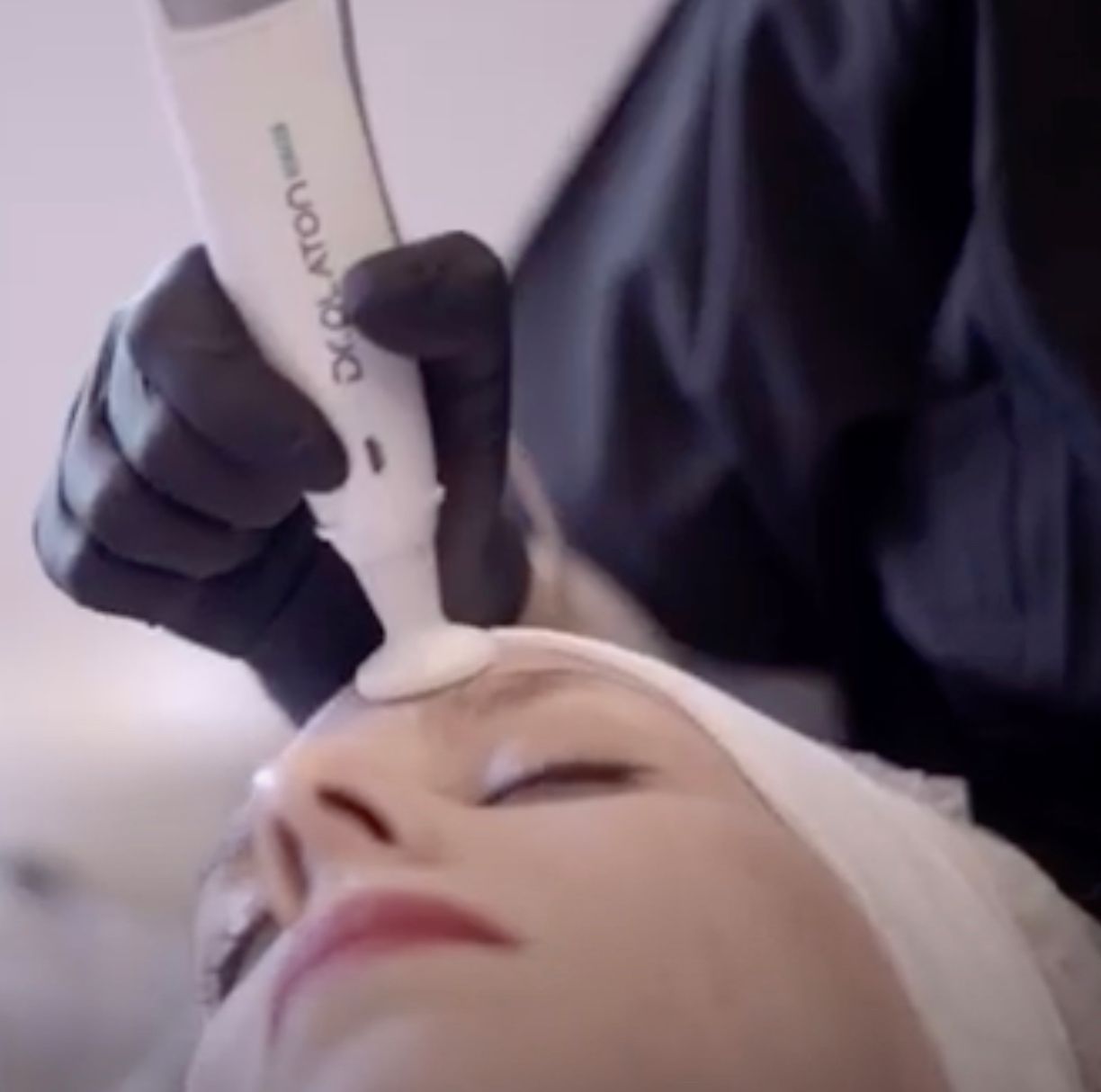 Eine mit Handschuhen bekleidete Kosmetikerin wendet in einem Spa-Umfeld ein Gesichtsbehandlungsgerät auf der Stirn einer Frau an.