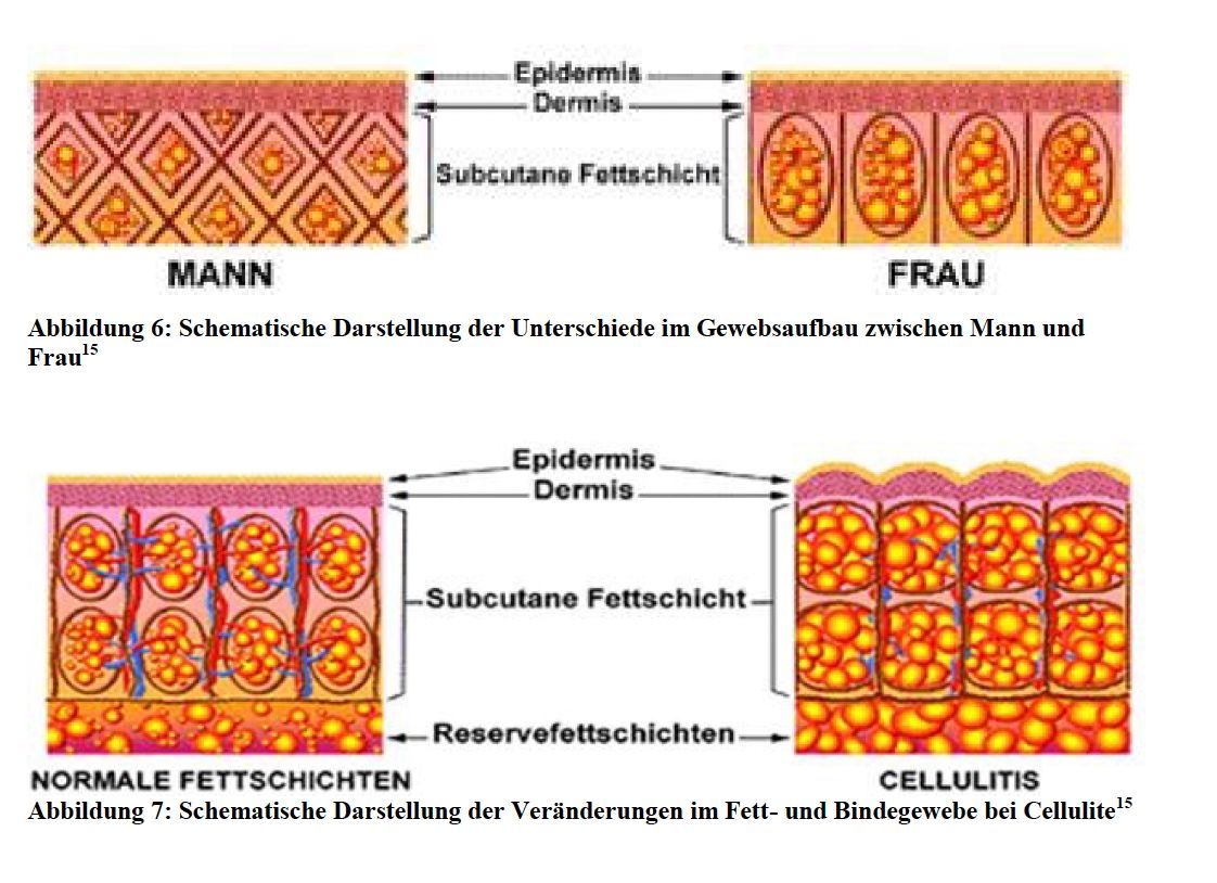 Diagramm zum Vergleich von Hautquerschnitten bei Männern und Frauen mit Beschriftungen für Epidermis, Dermis und Fettschichten.
