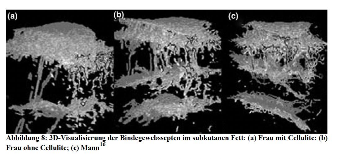 Drei Graustufen-Mikroskopiebilder, die poröse, verzweigte Strukturen zeigen, die mit a, b und c gekennzeichnet sind.