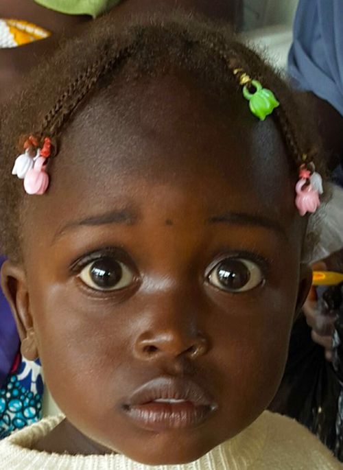 Close-up of a wide-eyed young black girl with braided hair and colorful clips