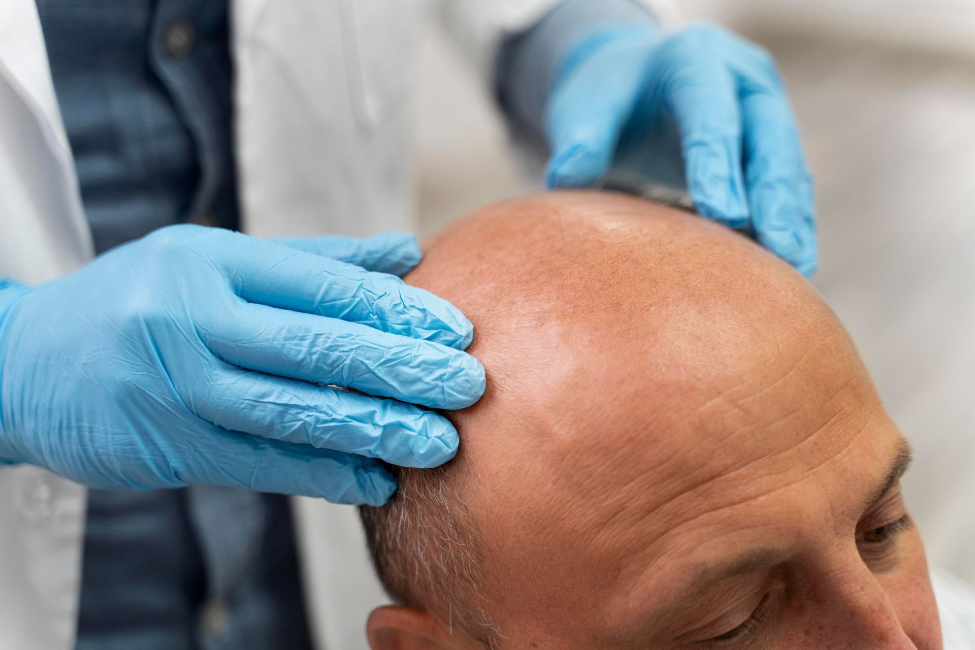 A person's bald head being examined by gloved hands.