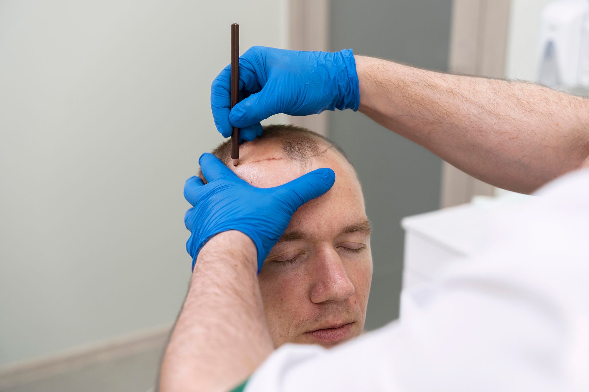 A person with closed eyes has their head examined. A gloved hand holds a pen.