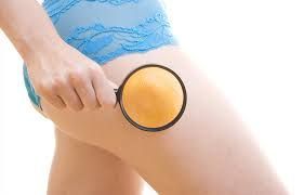 OrangeLase™ is een innovatieve niet-invasieve behandeling van cellulitis die kan worden uitgevoerd met Fotona's L-Runner®- en T-Runner®-scanners. Het maakt de huid effectief strakker, verhoogt de elasticiteit en vermindert de zichtbaarheid van cellulitis.OrangeLase™ vermindert effectief de zichtbaarheid van cellulitis. Het maakt oneffenheden op het huidoppervlak glad en vermindert de uitwendige manifestatie van cellulitisbultjes. Het vereist weinig tot geen downtime.