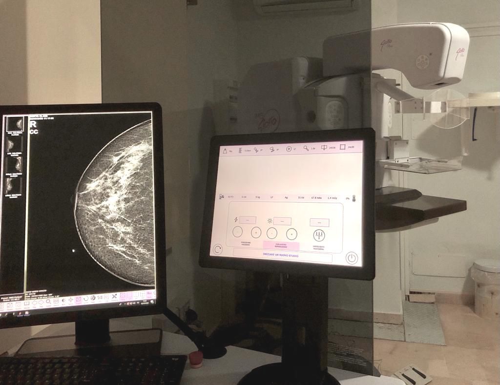 mammografia