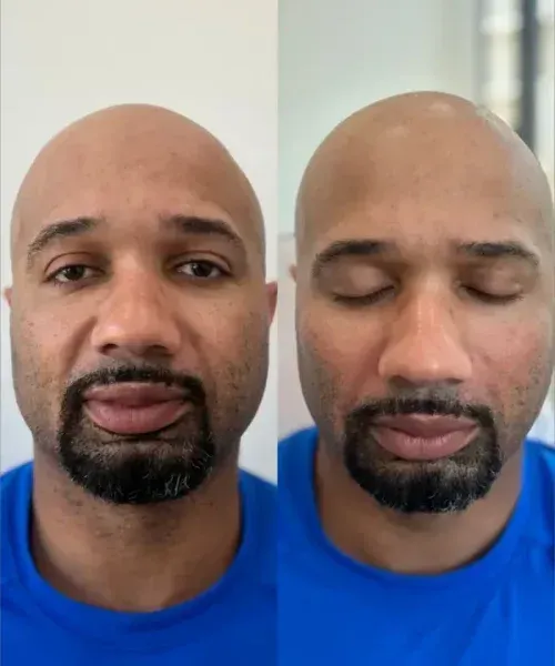 Side-by-side face shots of a bald man with a goatee, eyes open on left and closed on right, wearing a blue shirt