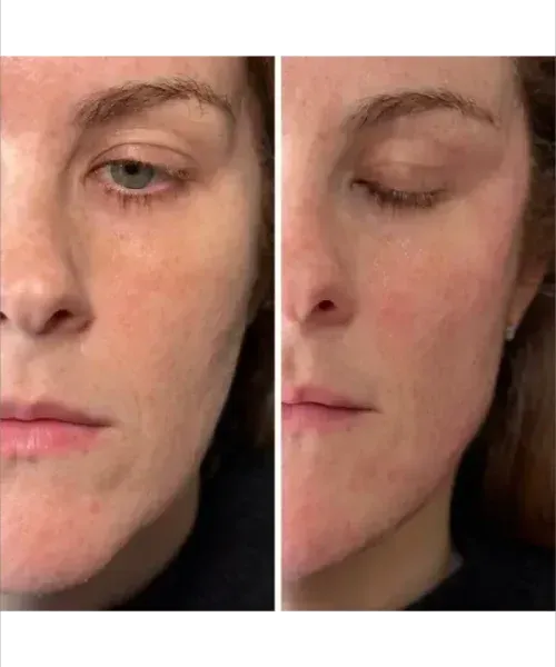 Close-up side-by-side face photos of a woman, one with eyes open and one with eyes closed.