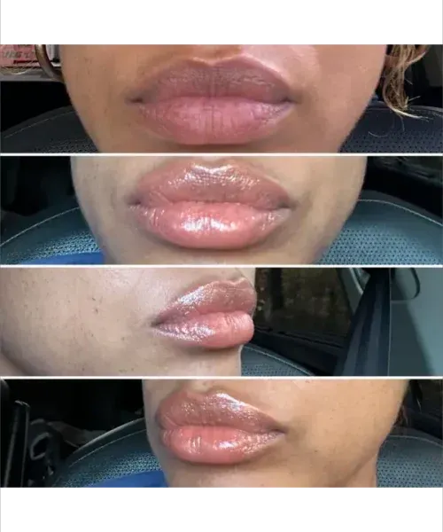 Four close-up views of glossy lips from the front and side angles.