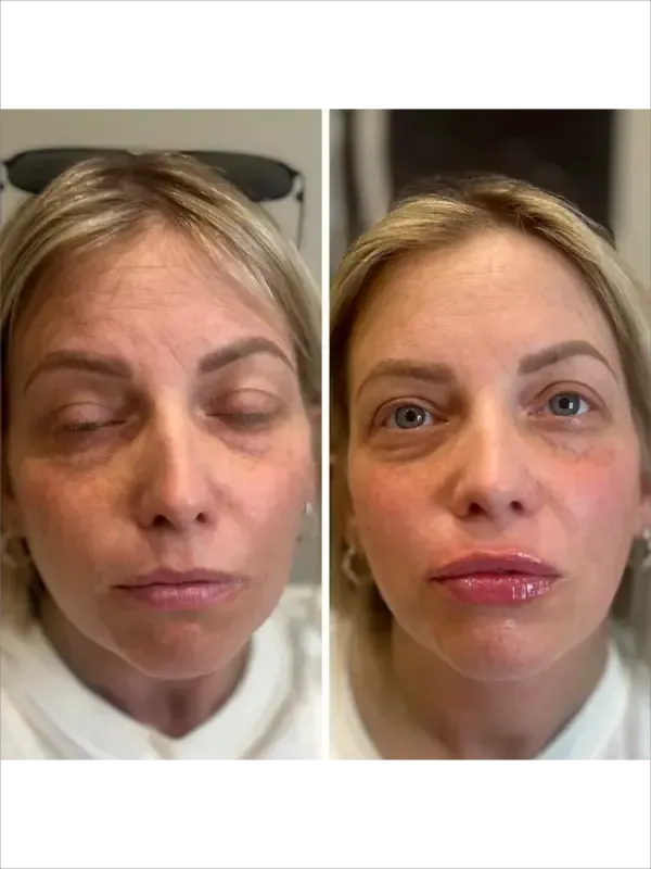 Side-by-side facial comparison showing closed eyes on the left and open eyes on the right.
