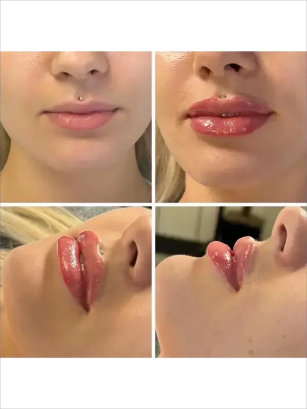 Four close-up views of lips before and after glossy red lipstick application