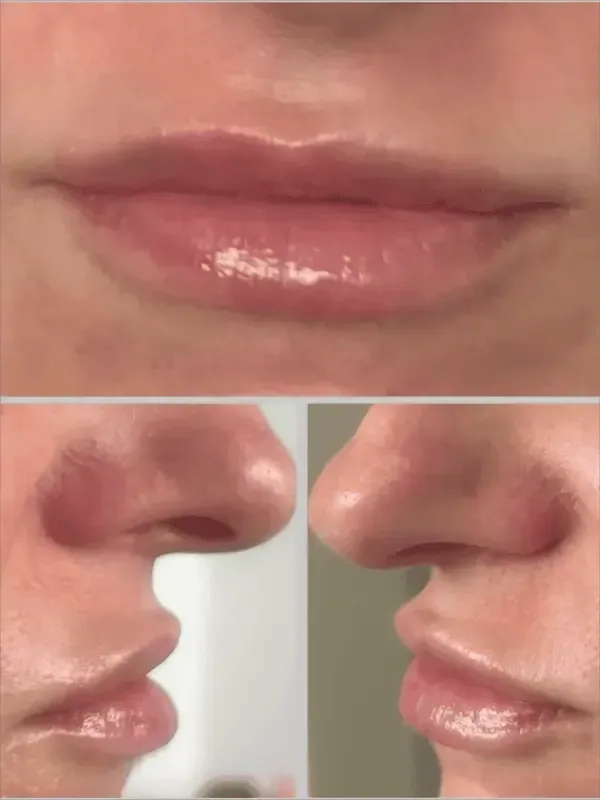 Close-up of glossy pink lips, with side-profile views of the mouth and nose below.