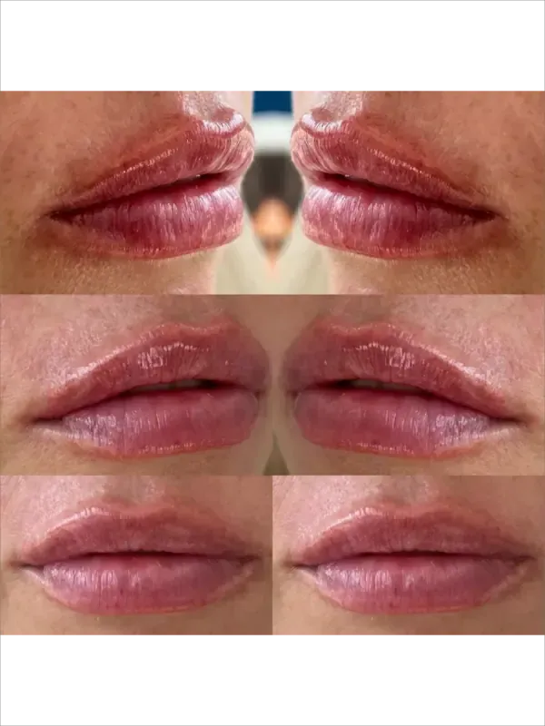 Close-up collage of three lip close-ups showing slightly chapped, glossy pink lips from different angles