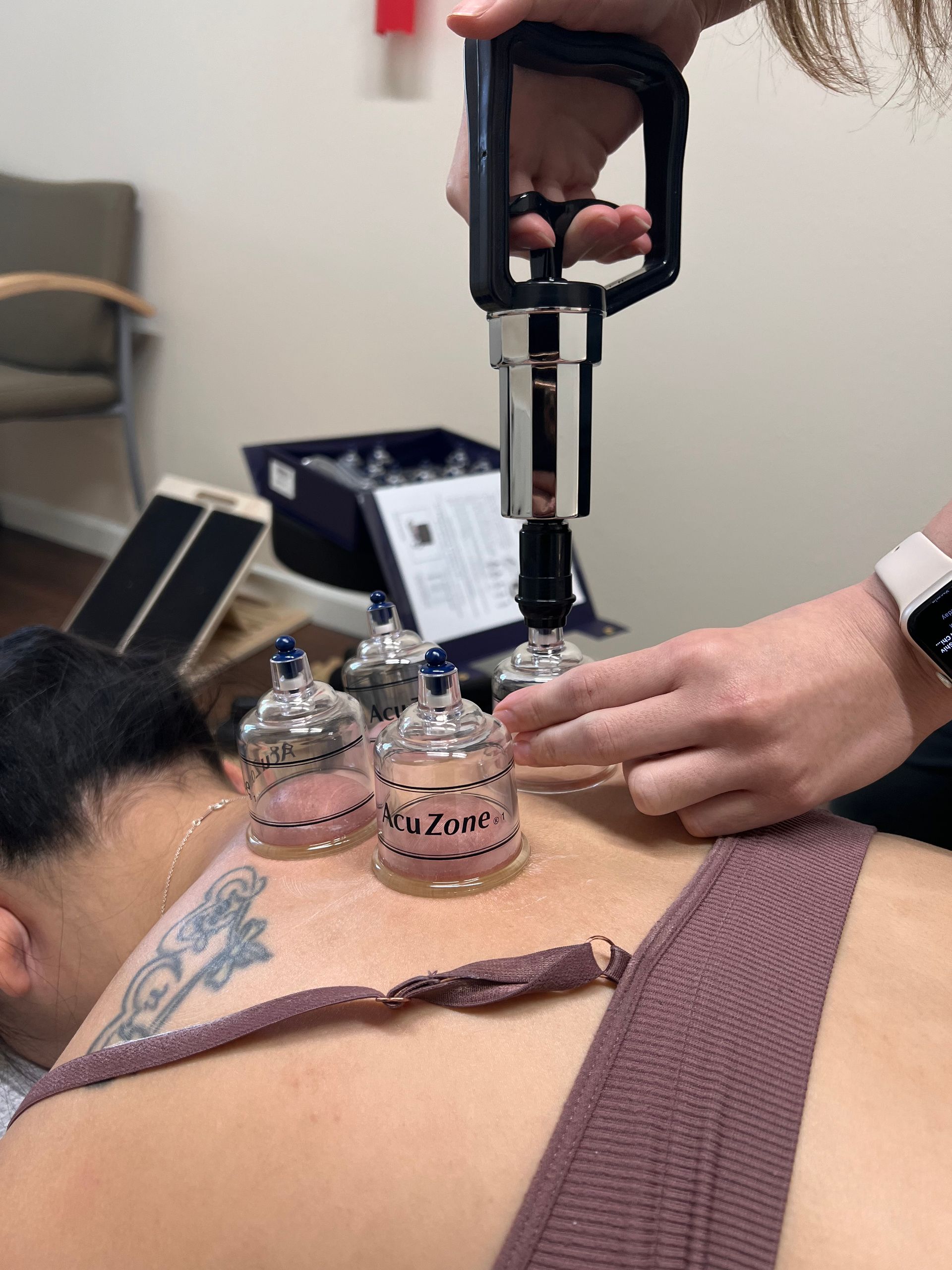a woman is getting a cupping treatment on her back .