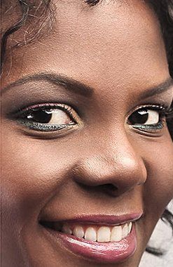 Lasik Eye