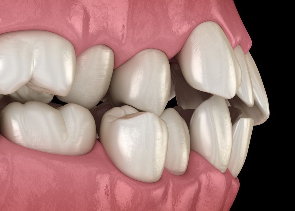 A gloved professional points to a specific area on a panoramic dental X-ray displayed on a screen.