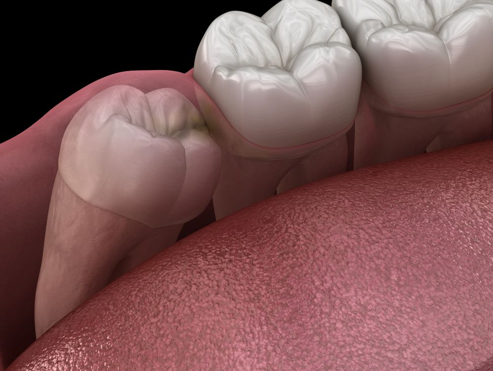 A gloved professional points to a specific area on a panoramic dental X-ray displayed on a screen.