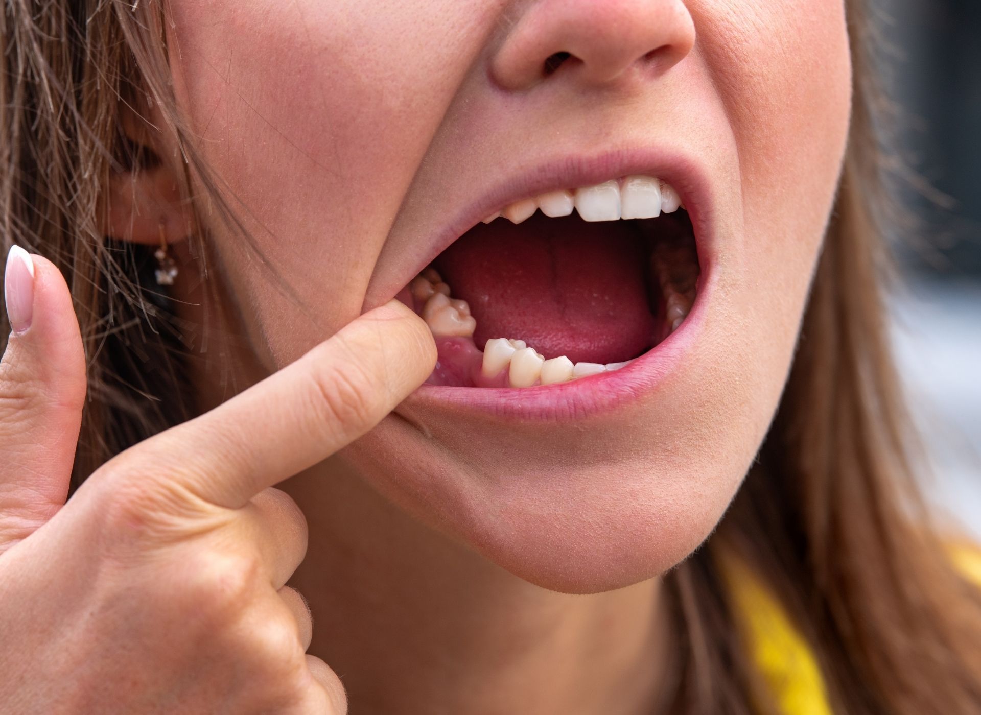 A gloved professional points to a specific area on a panoramic dental X-ray displayed on a screen.