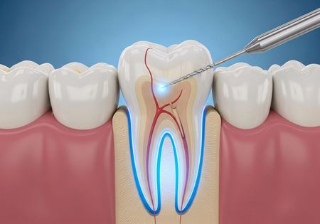 A gloved professional points to a specific area on a panoramic dental X-ray displayed on a screen.