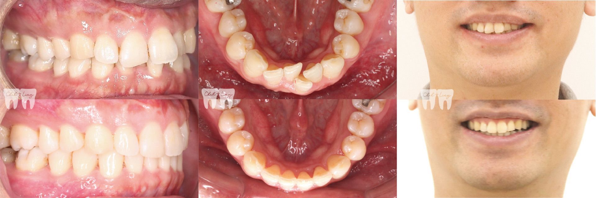 bravodental101