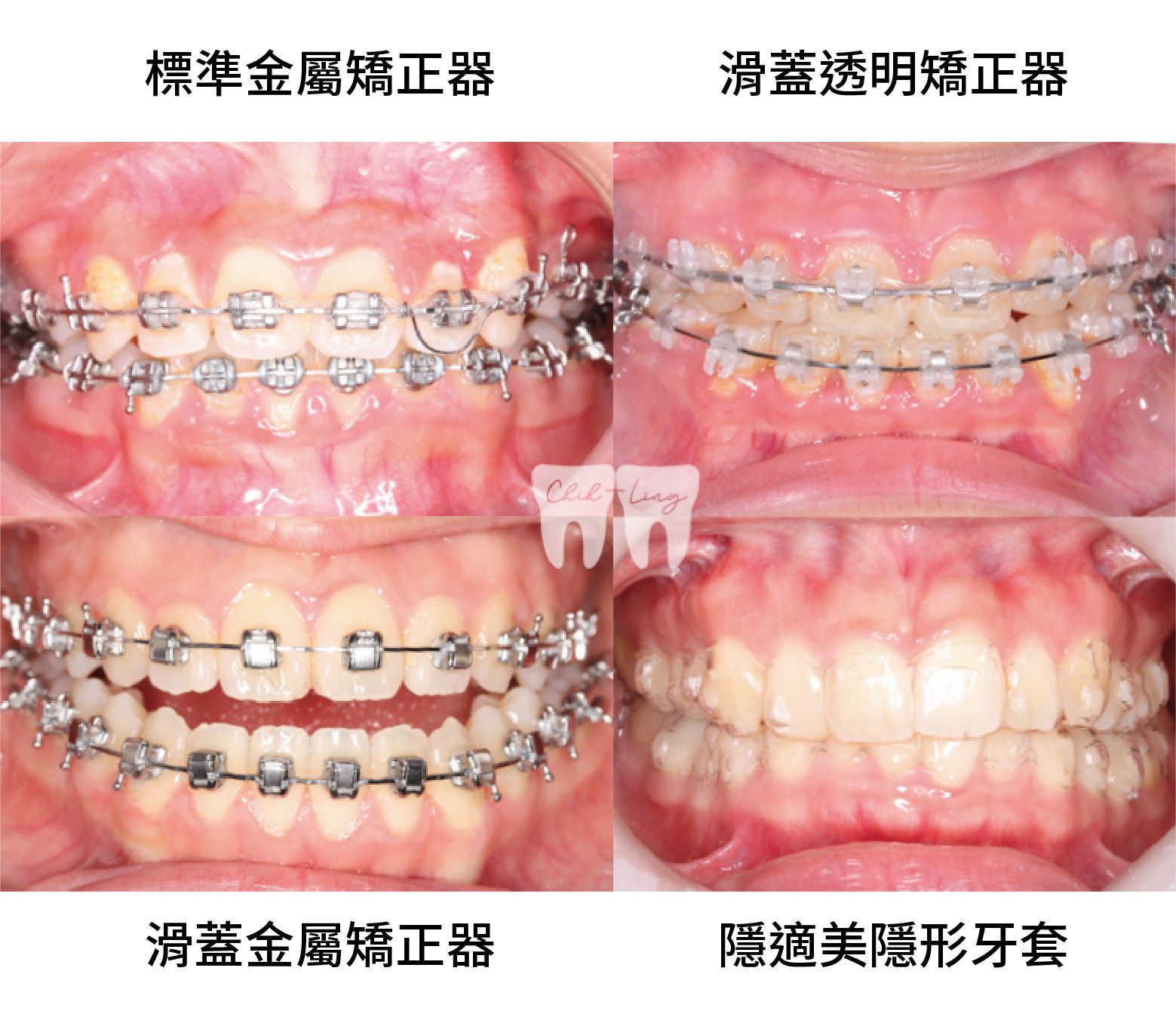 bravodental101