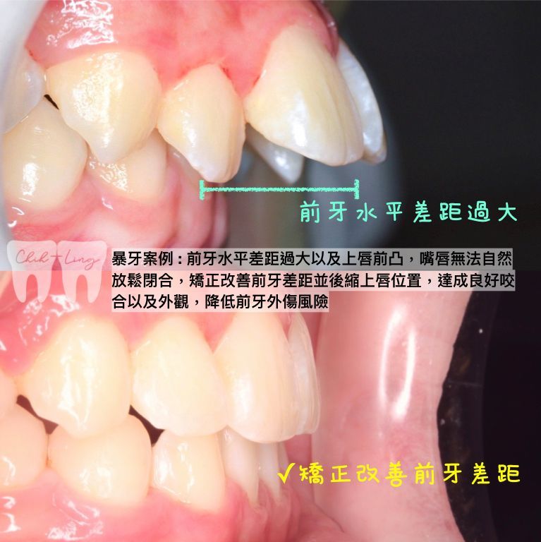 bravodental101