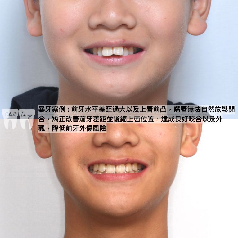 bravodental101