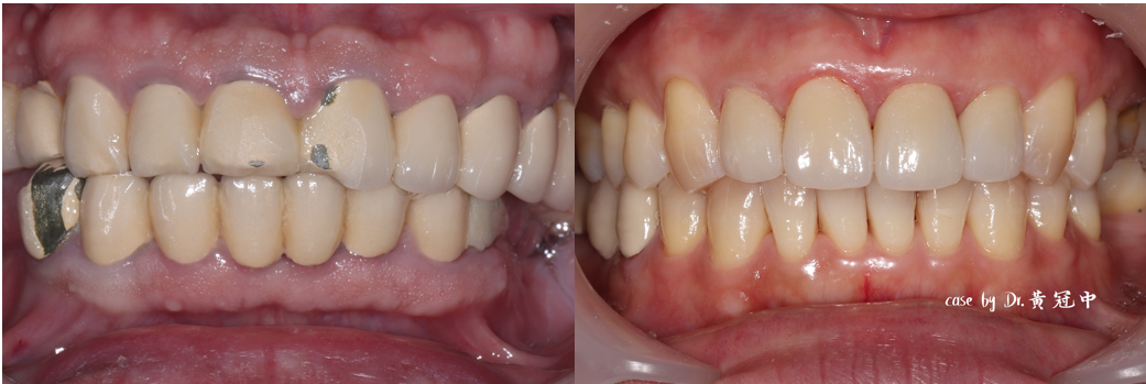 bravodental101