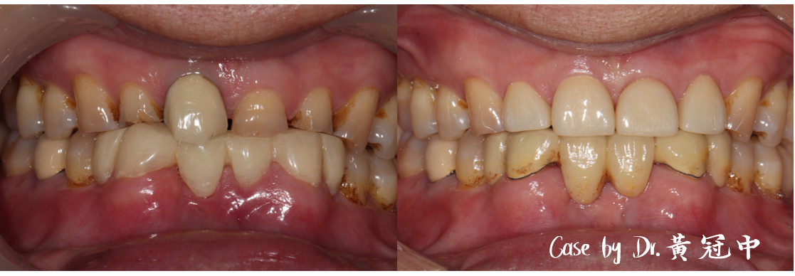bravodental101