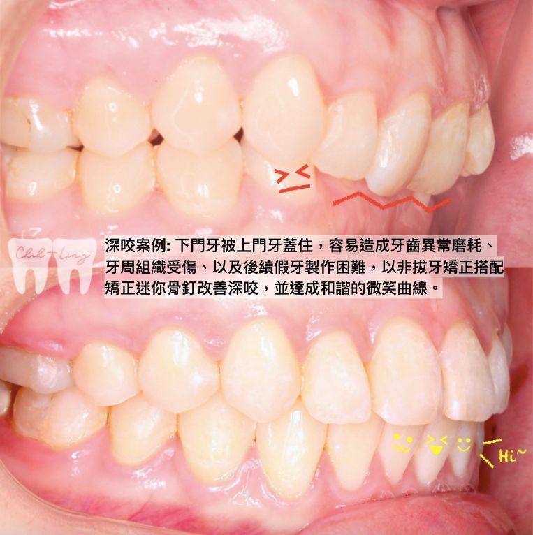 bravodental101