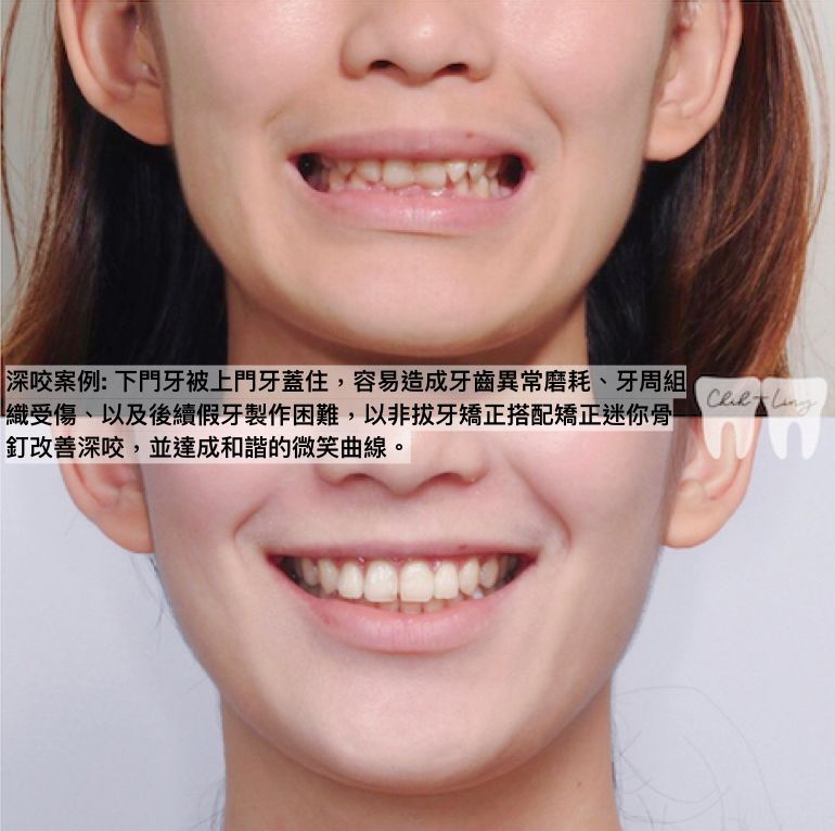 bravodental101