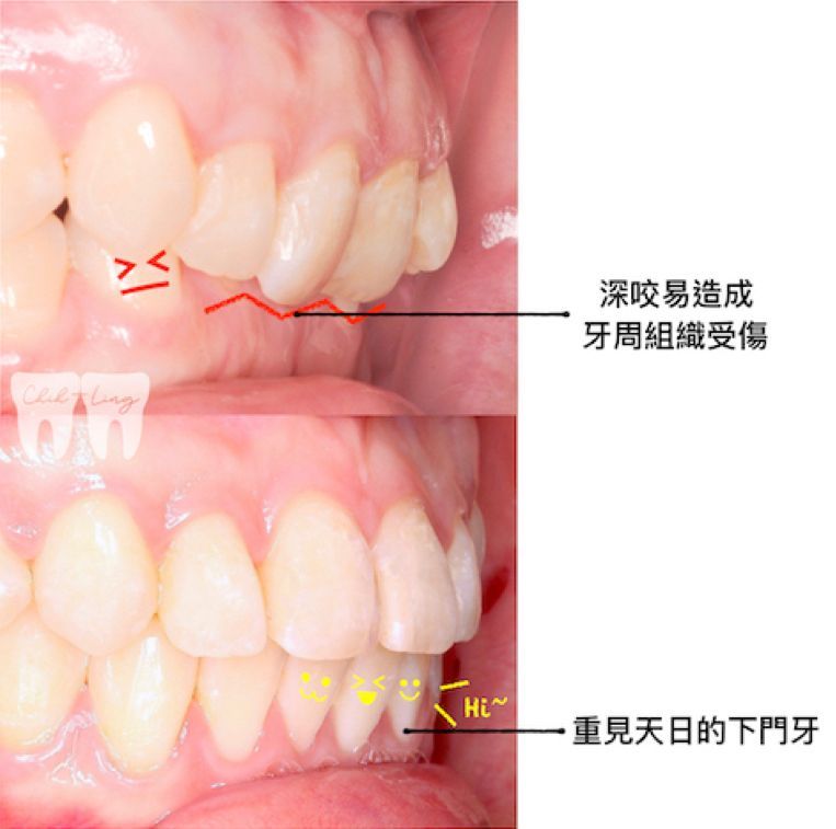 bravodental101