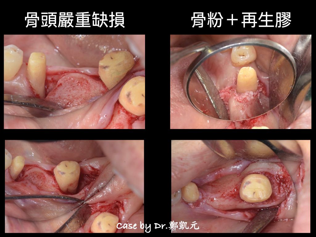 bravodental101