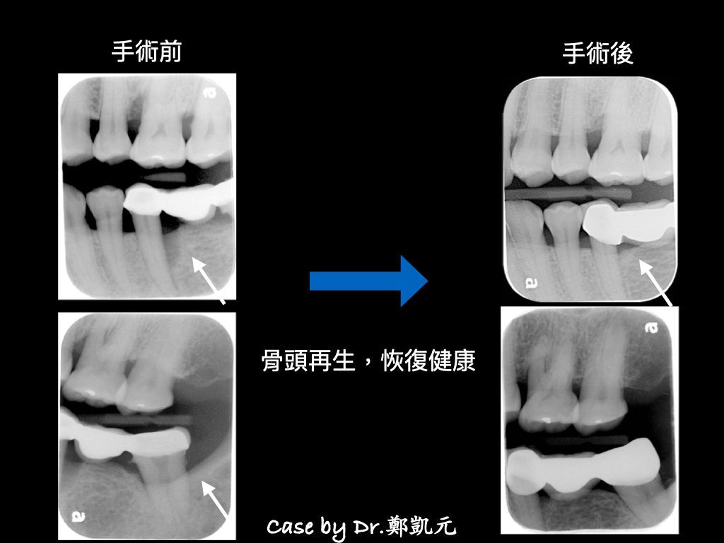 bravodental101