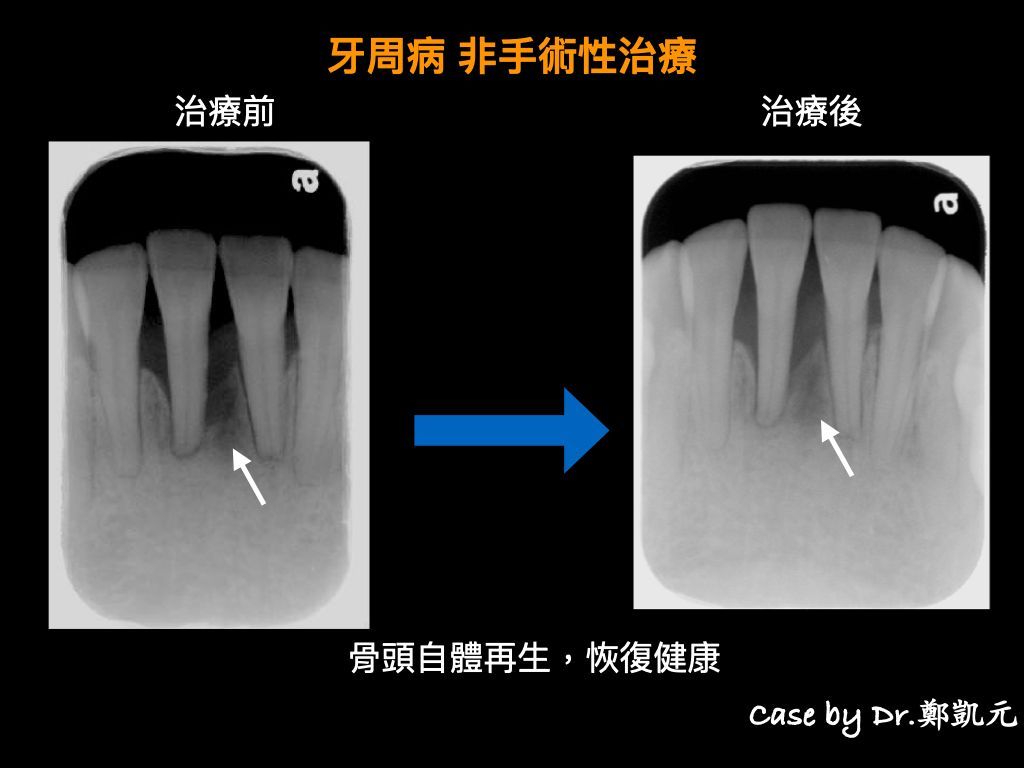 bravodental101